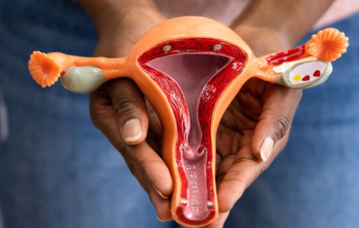 PCOS